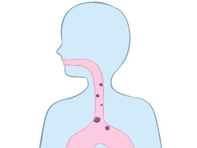呼吸系統(tǒng)疾病
